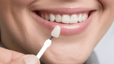 What Cosmetic Dentistry Can Do for Your Smile