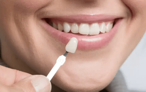 What Cosmetic Dentistry Can Do for Your Smile